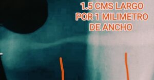 Mayo Clinic Care Network